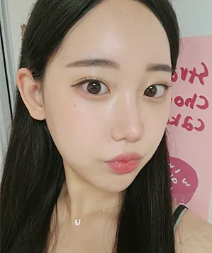 id Hospital - id Real Selfie - Chaeyeon Kwon After