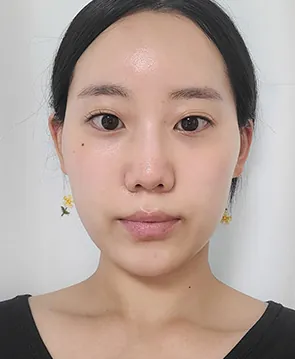 id Hospital - Real Selfies - Chaeyeon Kwon - 1