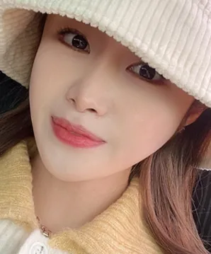 id Hospital - id Real Selfie - Jiyeon Lee After