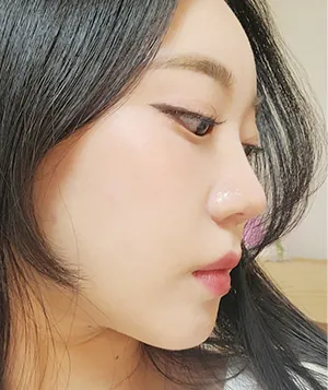 id Hospital - Real Selfies - Chaeyeon Kwon - 4