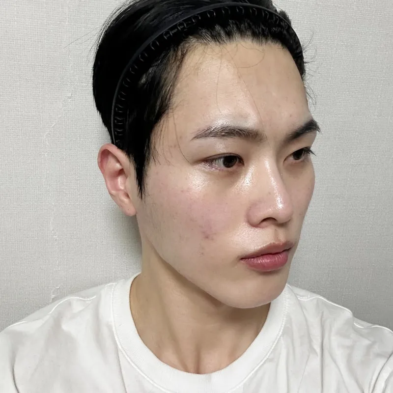 id Hospital - id Real Selfie - JaeHyun Lim Before