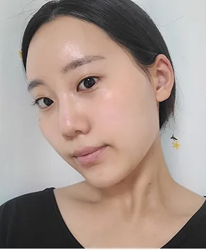 id Hospital - id Real Selfie - Chaeyeon Kwon Before