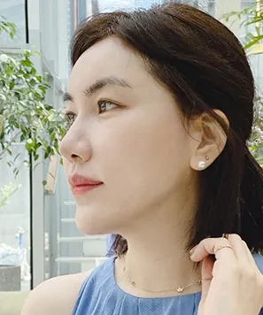 id Hospital - id Real Selfie - Jihye Choi After