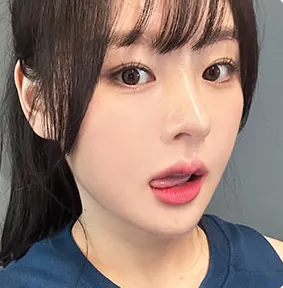id Hospital - id Real Selfie - Kyunghee Lee After