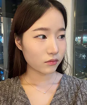 id Hospital - id Real Selfie - Olivia Before