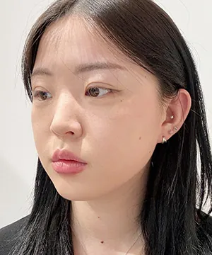 id Hospital - id Real Selfie - Ava Before