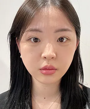 id Hospital - id Real Selfie - Ava Before