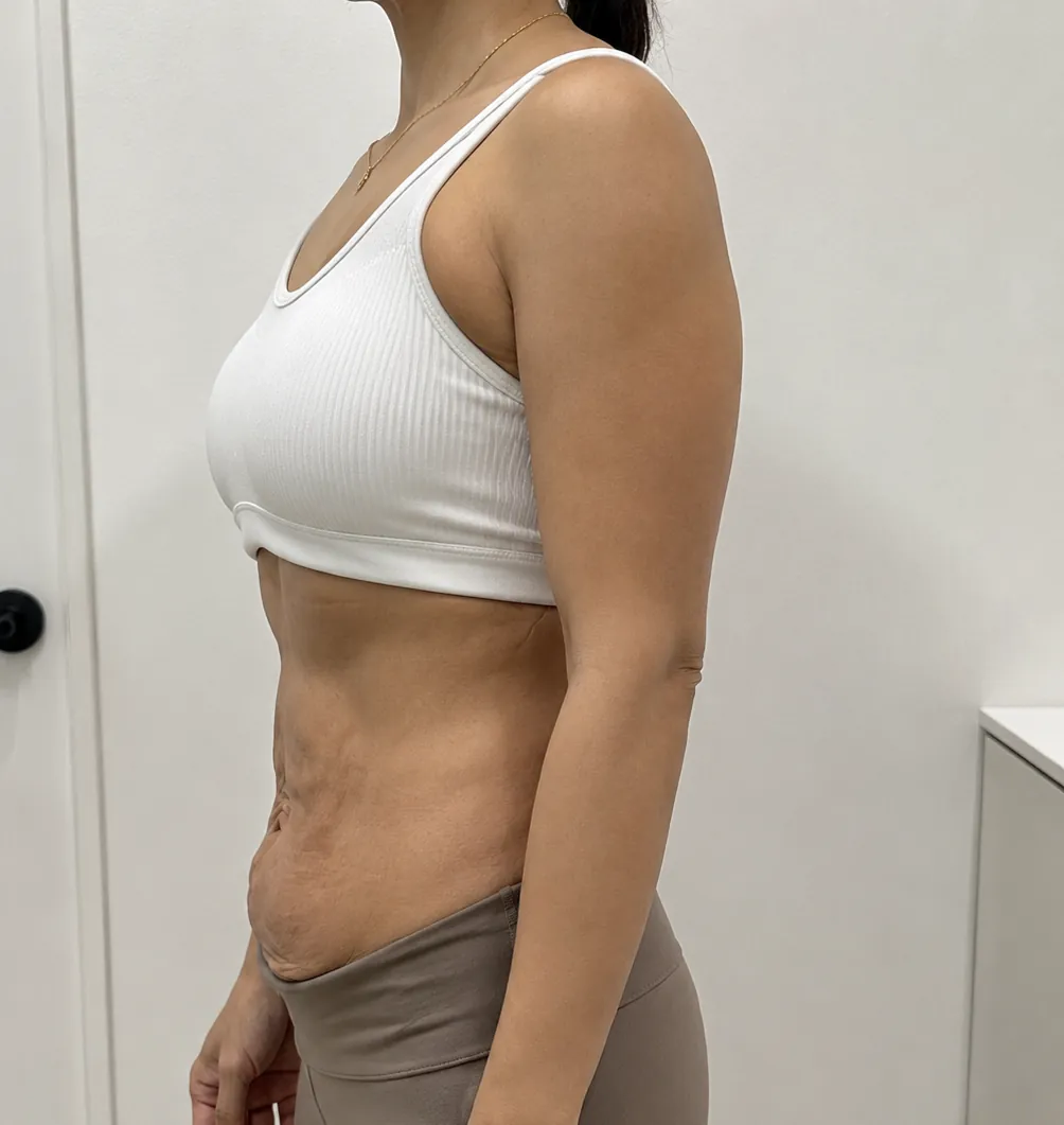 id Hospital - id Real Selfie - Melissa R. Before