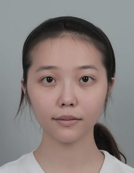 id Hospital - id Real Selfie - xiaoyunjing Before