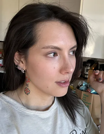 id Hospital - id Real Selfie - Noelle After