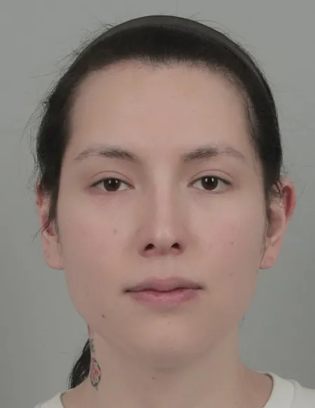 id Hospital - id Real Selfie - Noelle Before