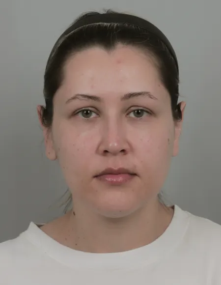 id Hospital - id Real Selfie - kiseleva Before