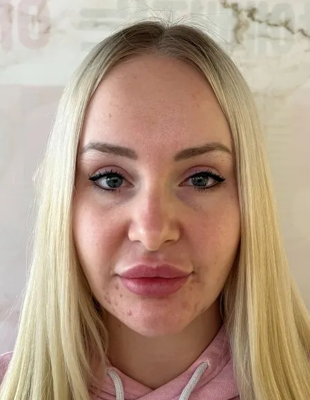 id Hospital - id Real Selfie - Jazmyn Before