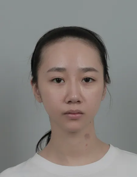 id Hospital - id Real Selfie - loweiju Before