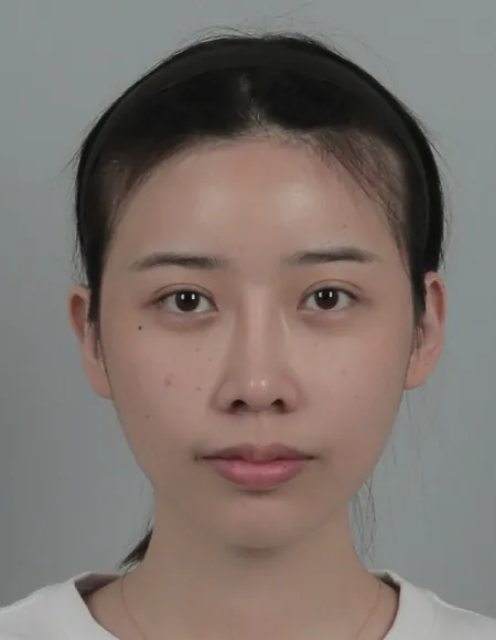 id Hospital - id Real Selfie - yangching Before