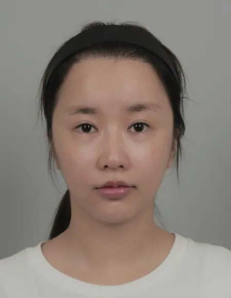 id Hospital - id Real Selfie - wanggongmengyan Before
