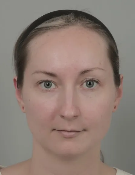 id Hospital - id Real Selfie - Holly Before