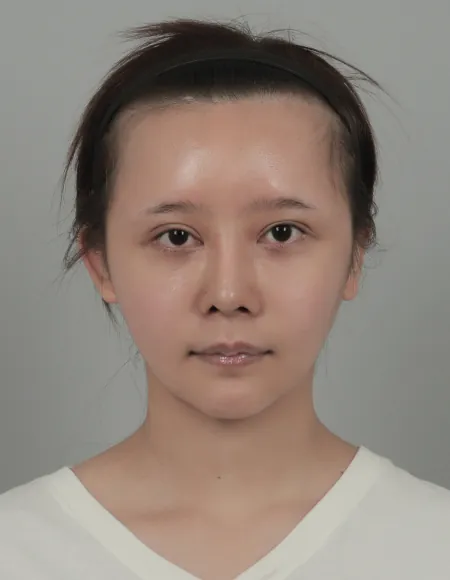 id Hospital - id Real Selfie - pengxinrui Before