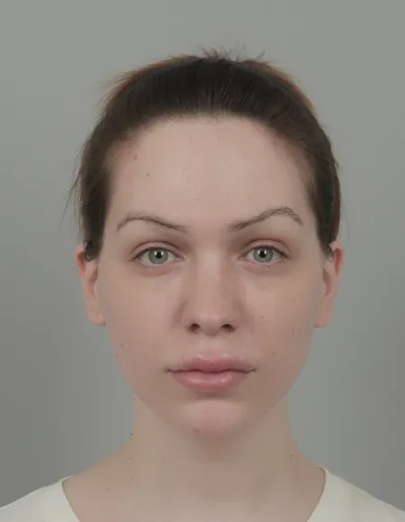 id Hospital - id Real Selfie - Danielle Before
